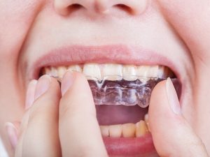 teeth, health, smile,dentist, dentalhealth, oralhealth