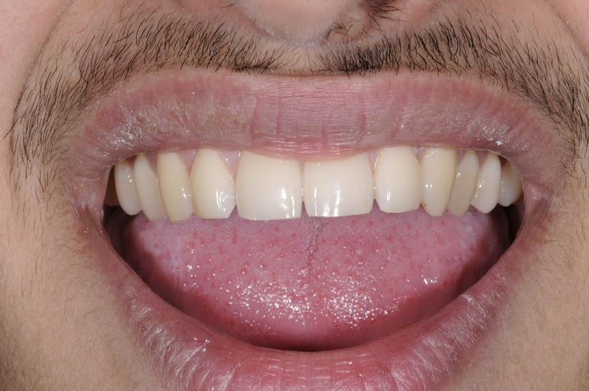Before Image