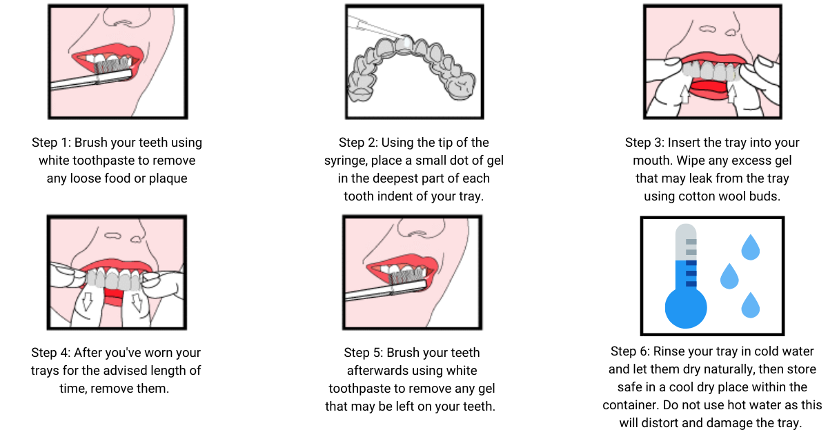 Teeth Whitening At Home Instructions